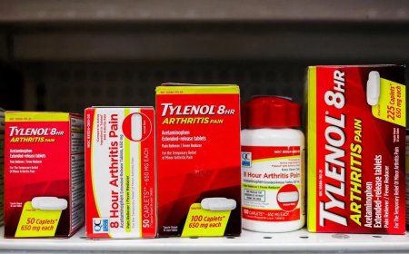 研究：按建议剂量 孕妇可服用扑热息痛