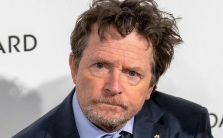 Michael J. Fox Explains Why His ‘Shrinking’ Role Is Not a Full Acting Comeback