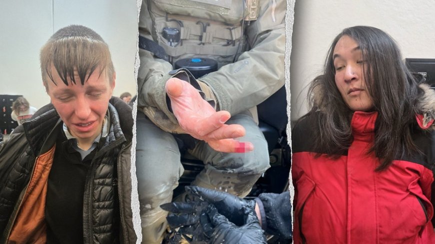 Anti-ICE agitator allegedly bites off federal officer's finger during Minneapolis attack