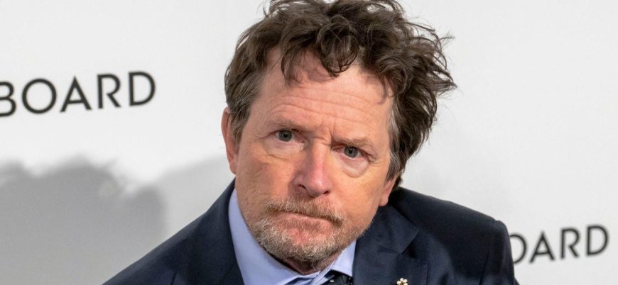 Michael J. Fox Explains Why His ‘Shrinking’ Role Is Not a Full Acting Comeback