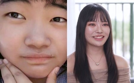 被前男友羞辱醜！21歲櫻花妹砸19萬整形重生　換臉對比照曝