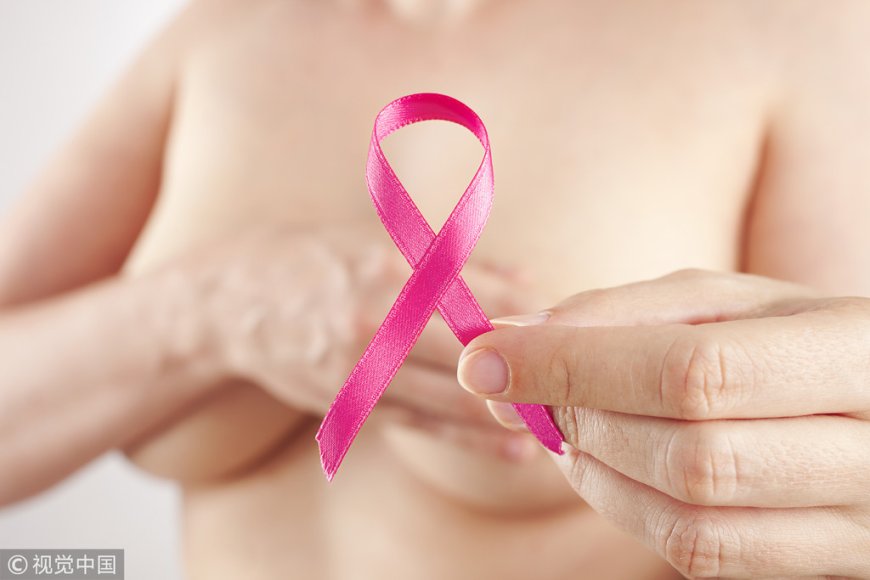 乳房鈣化2成與乳癌有關　她摸到硬塊「鋼針定位切除手術」助確診