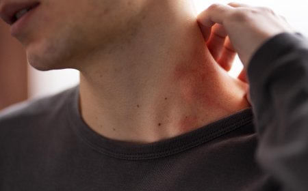 「皮蛇」不只長疹子！帶狀皰疹神經痛恐拖數年...40年老中醫：氣通就不痛