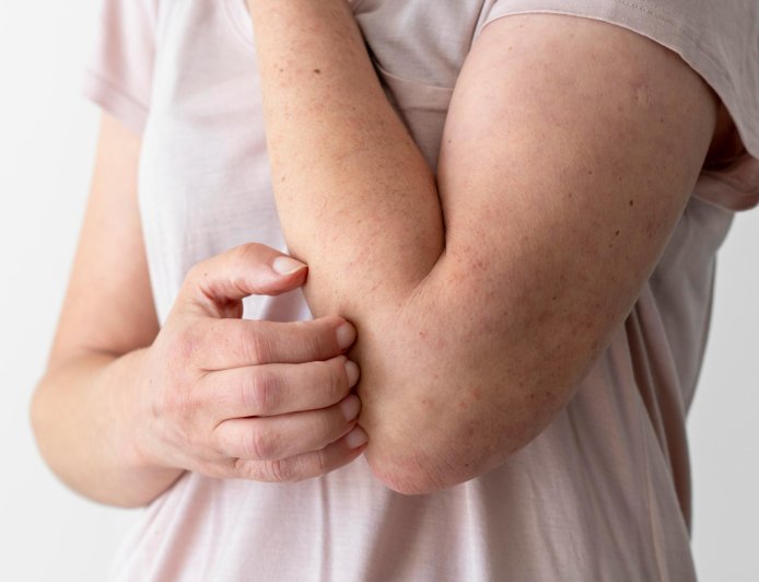 清明一到全身發癢、濕疹反覆發作？中醫揭3大誘因及「內外調養」關鍵